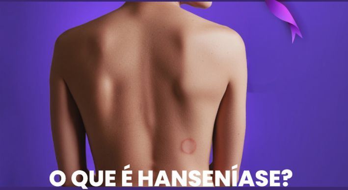 Programação Campanha Hanseniase 2026